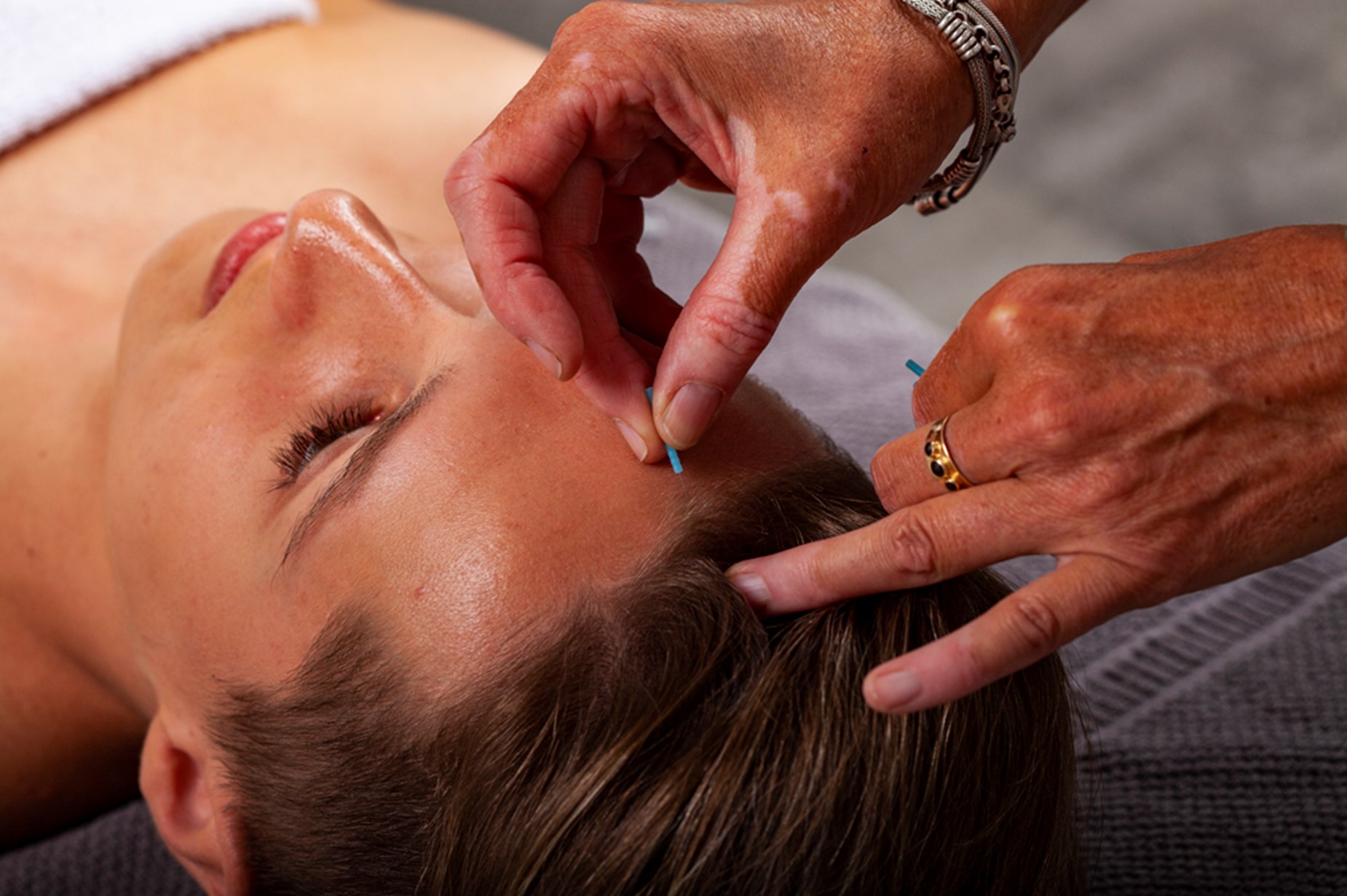 Uitbreiding specialisme Dry Needling